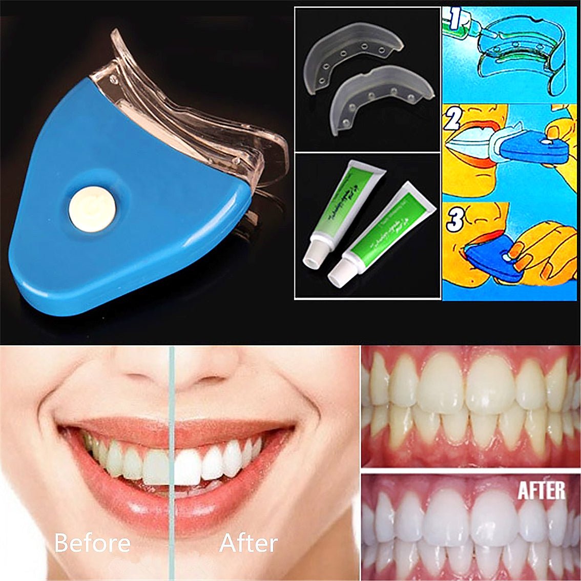 Oral Gel Teeth Tooth Whitening Whitener Dental Bleaching LED - exquisiteblur