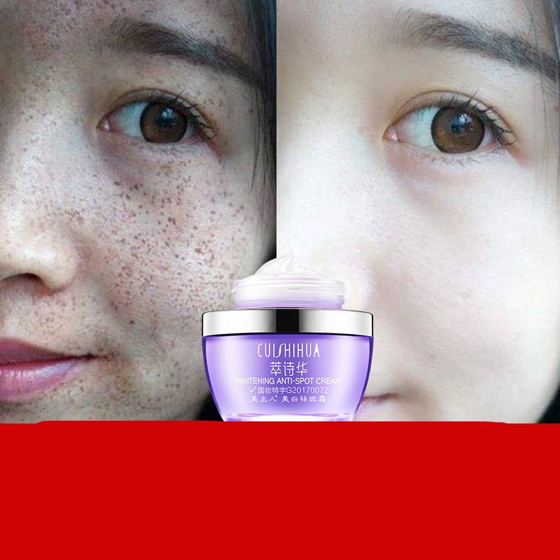 Whitening Freckle Cream - exquisiteblur